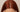 Top of model's head showing her healthy scalp