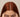 Top of model's head showing her healthy scalp